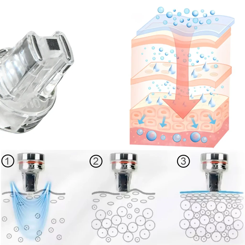 10-in-1 hydradermabrasion machine mesotherapy facial nutrient infusion principle