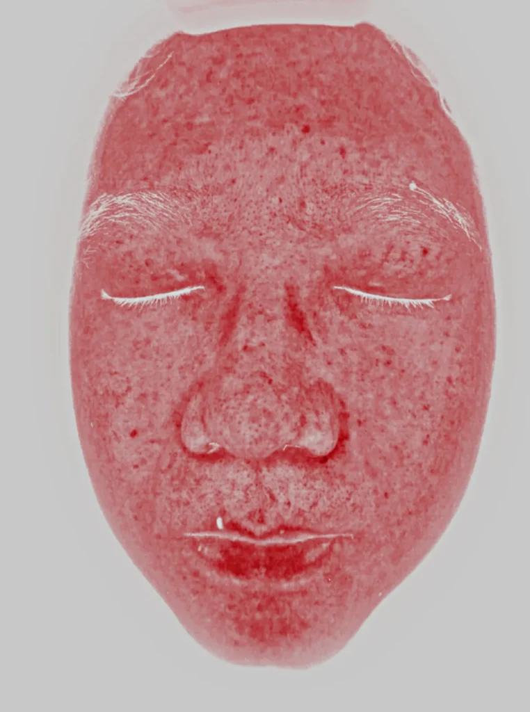 Intelligent skin analyzer 8-spectrum red pigment map skin analysis result