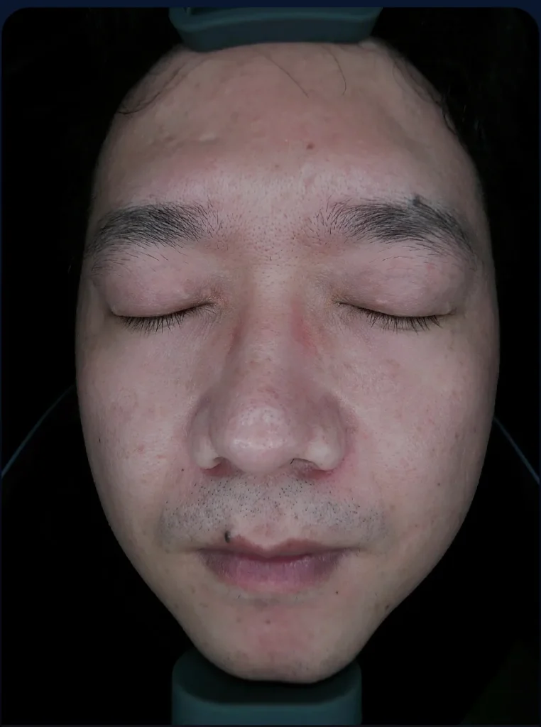 Intelligent skin analyzer 8-spectrum white light skin analysis result