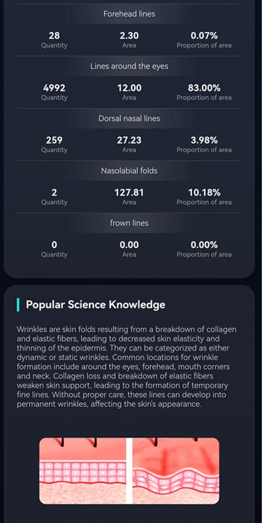 AI intelligent skin analyzer showing quantitative skin aging analysis report with data metrics