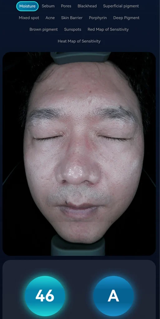AI intelligent skin analyzer machine capturing facial skin for professional analysis