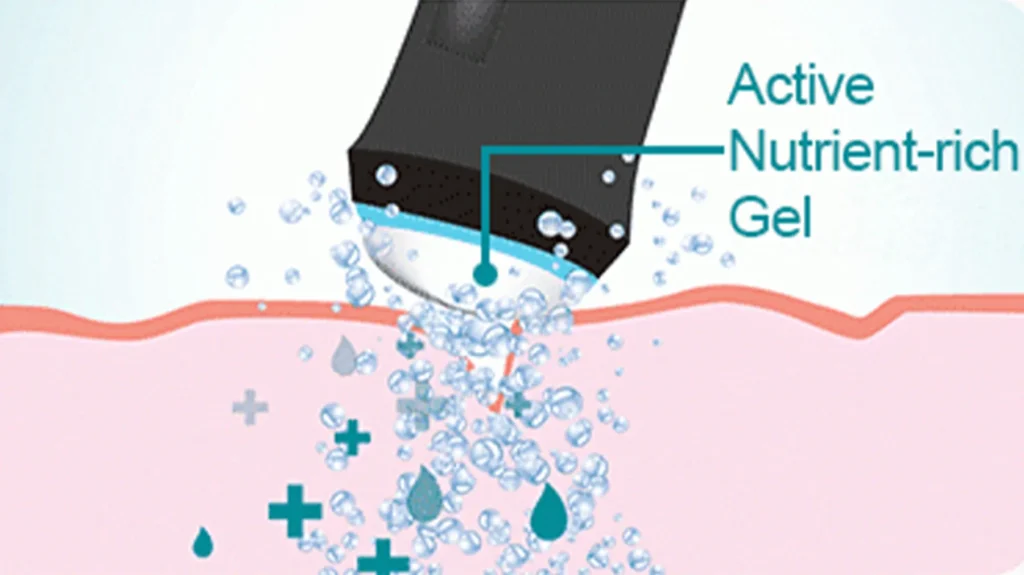 Oxygen Bubble Facial Machine Nutrient Infusion Principle Diagram
