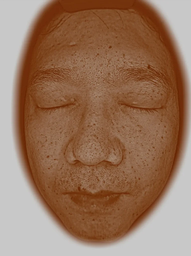 Carte brune pigmentaire 8 spectres Analyseur de peau intelligent par IA détection taches et mélanine