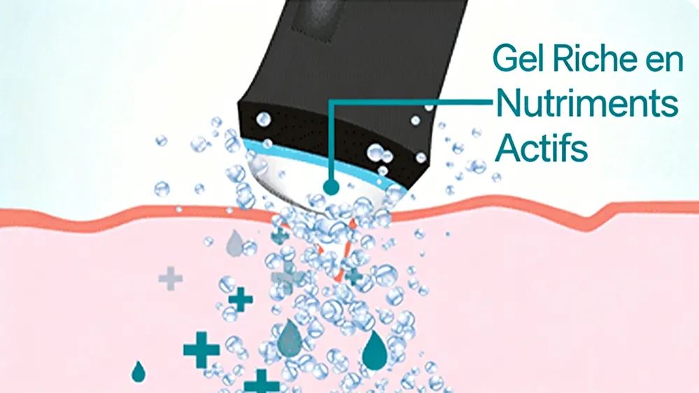 Schéma infusion gel actif Appareil Oxygène Visage, pénétration maximale des nutriments dans la peau