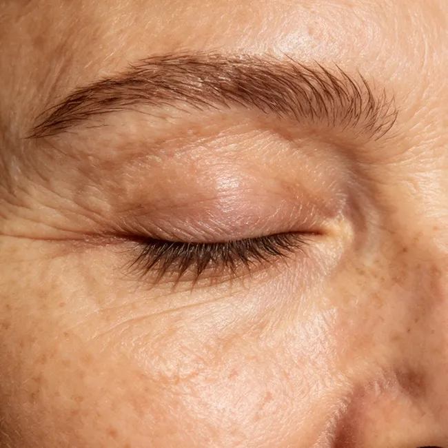 Contour des yeux avec ridules et rides fines à atténuer par appareil hydrodermabrasion multifonction 15 en 1