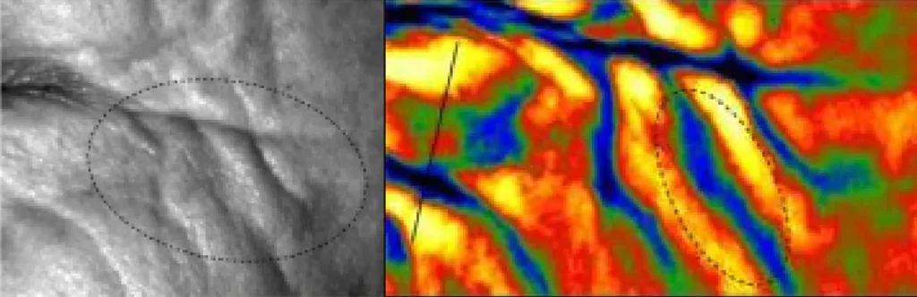 Before skin thermal scan before tripolar RF skincare treatment with oxygen facial machine, showing uneven facial skin texture and poor circulation pre facial rejuvenation therapy