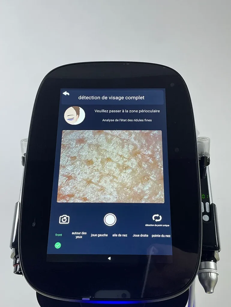 Capturer l’image du front conformément aux consignes sur l’appareil hydro dermabrasion