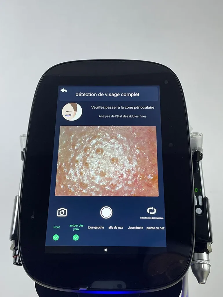 Capturer l’image de la zone oculaire conformément aux consignes sur l’appareil hydro dermabrasion