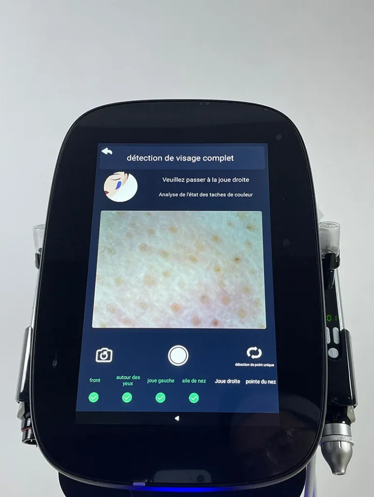 Capturer l’image des ailes du nez conformément aux consignes sur l’appareil hydro dermabrasion