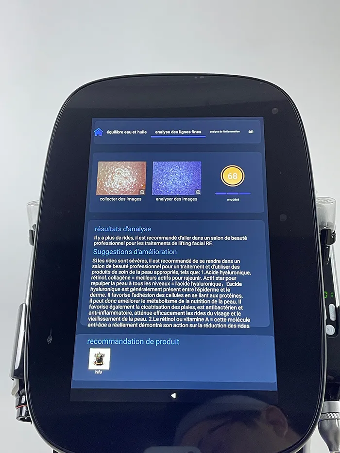 Step 12 for Skin Analysis System operation on Hydro Dermabrasion Facial Machine, display the fine wrinkles analysis report