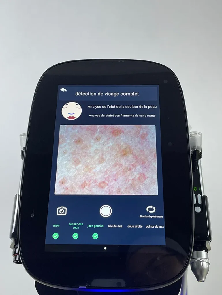 Step 5 for Skin Analysis System on Hydro Dermabrasion Facial Machine, capture images of the left cheek following the instructions