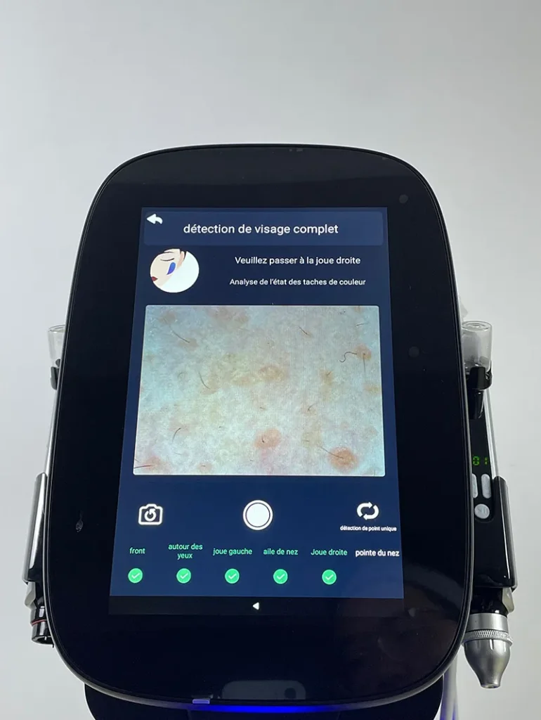 Step 7 for Skin Analysis System operation on Hydro Dermabrasion Facial Machine, capture images of the right cheek following the instructions