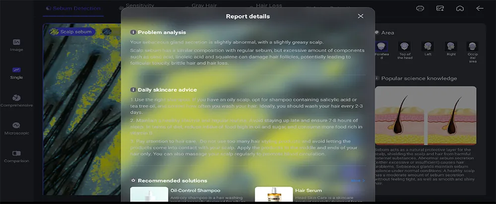 Hair and scalp analysis machine single independent report details with problem analysis, daily skincare advice and recommended solutions