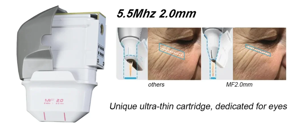 7D Portable HIFU machine eye treatment cartridge, HIFU probe for eye area wrinkle removal, under-eye skin tightening transducer