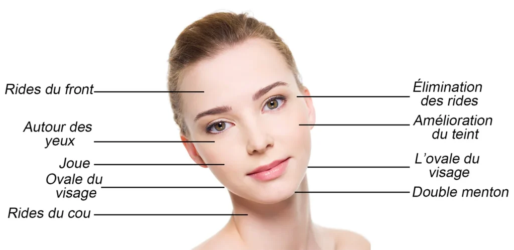 Machine HIFU 7D Visage Portable zones de traitement du visage, lifting et soin anti-rides pour différentes zones faciales